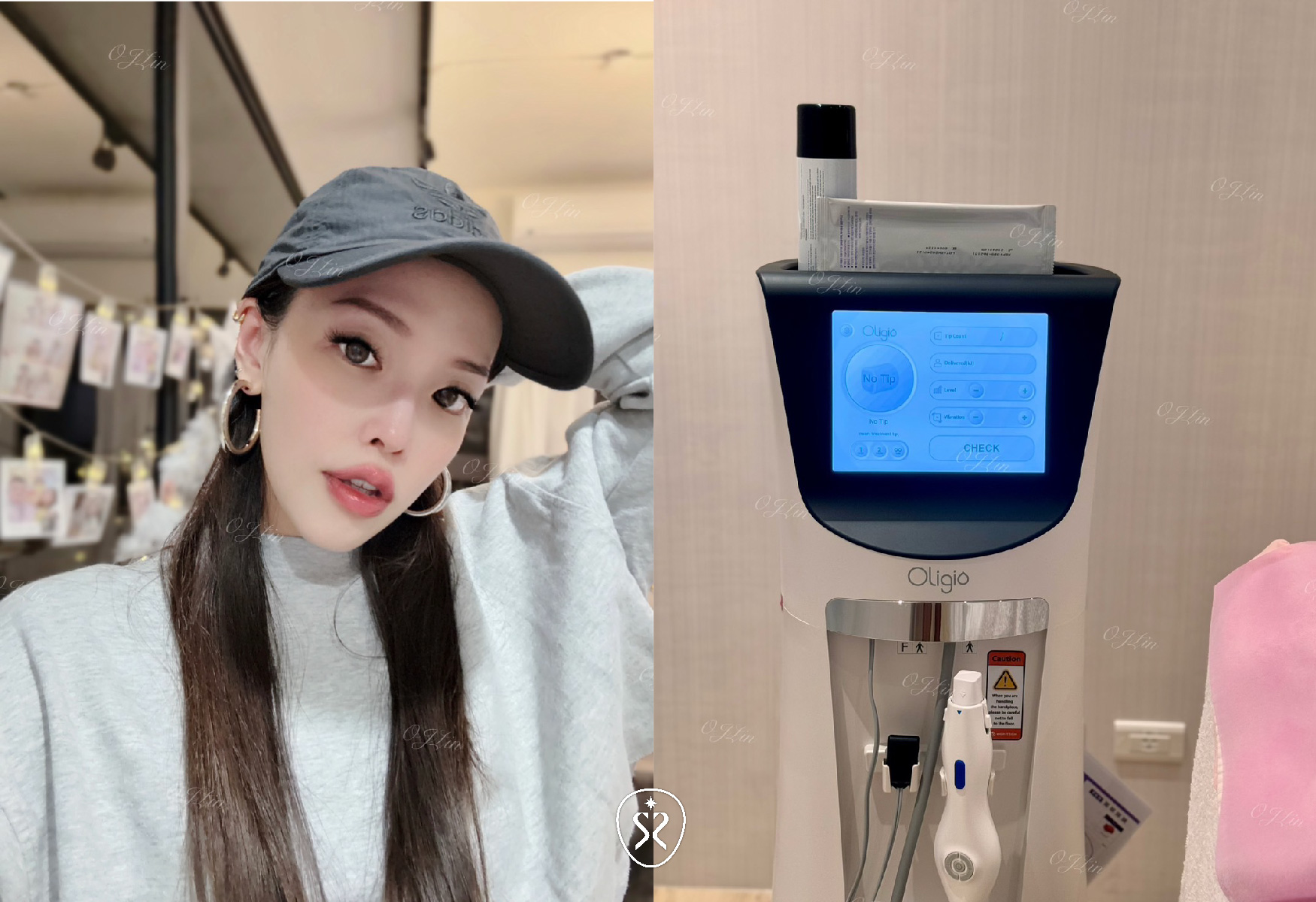 來試試小資族美麗福音，完美電波非侵入式電波拉皮療程